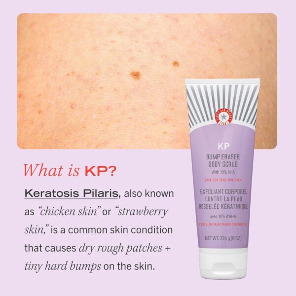 First Aid Beauty - KP Bump Eraser Body Scrub with 10% AHA, Keratosis Pilaris Skin Exfoliater with Glycolic and Lactic acids, Helps Reduce Chicken Skin Bumps, Safe for Sensitive Skin, 8 oz - Image 6