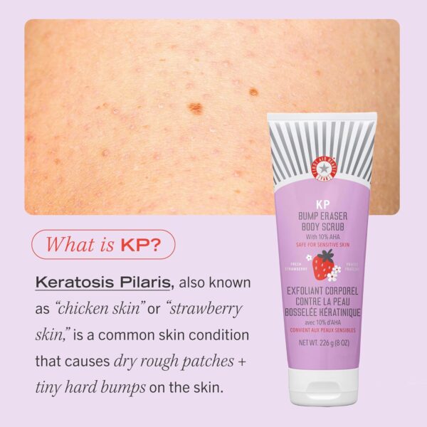 First Aid Beauty - KP Bump Eraser Body Scrub with 10% AHA, Keratosis Pilaris Exfoliater with Glycolic and Lactic acids, Helps Reduce Chicken Skin Bumps, Safe for Sensitive Skin, Strawberry Scent, 2 oz - Image 8