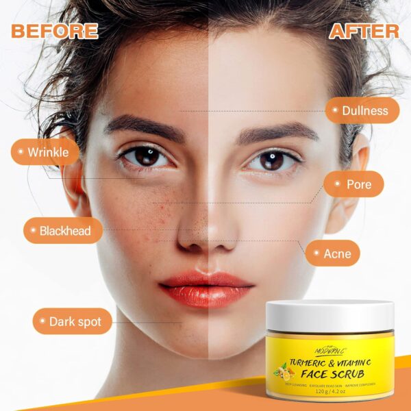 Vitamin C and Turmeric Face Scrub Cream Organics Microdermabrasion Facial Scrub Exfoliating Clears Blackheads Improve Dark Spot Acne with Strawberry Extract Exfoliator - Image 4