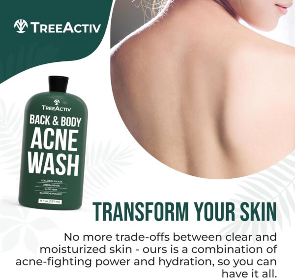 TreeActiv Acne Exfoliating Body Wash, 8oz, Foam Cleanser for All Skin Types, Sulfur, Aloe Vera, Jojoba Beads - Image 4