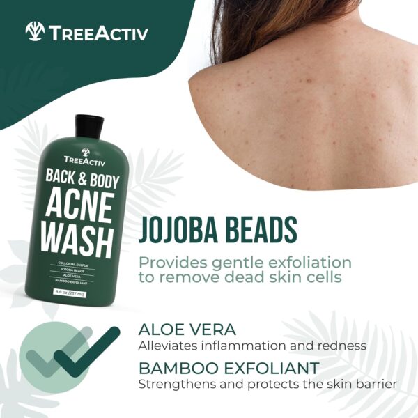 TreeActiv Acne Exfoliating Body Wash, 8oz, Foam Cleanser for All Skin Types, Sulfur, Aloe Vera, Jojoba Beads - Image 7