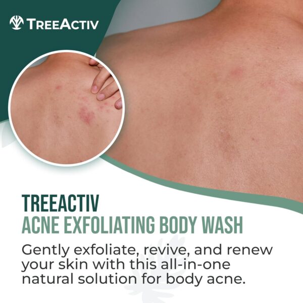 TreeActiv Acne Exfoliating Body Wash, 8oz, Foam Cleanser for All Skin Types, Sulfur, Aloe Vera, Jojoba Beads - Image 3