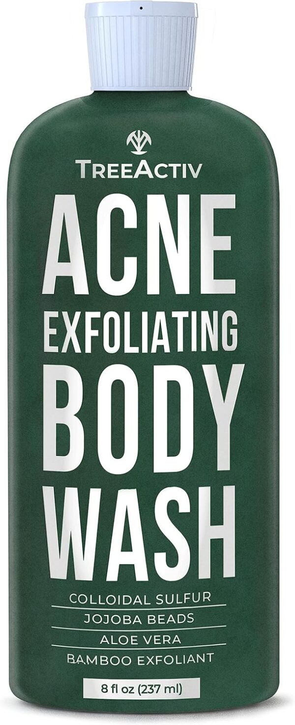 TreeActiv Acne Exfoliating Body Wash, 8oz, Foam Cleanser for All Skin Types, Sulfur, Aloe Vera, Jojoba Beads